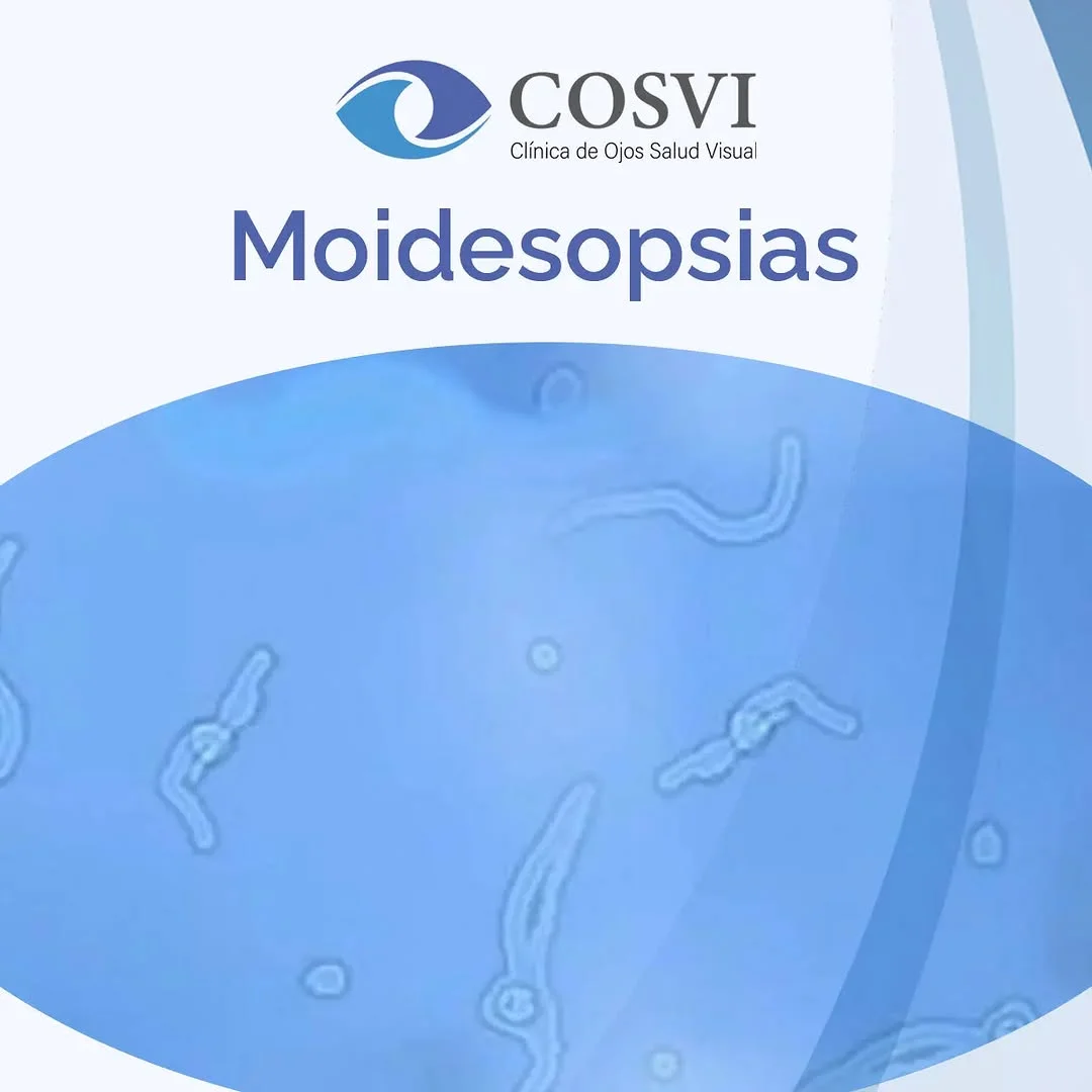 Miodesopsias (Moscas volantes)
