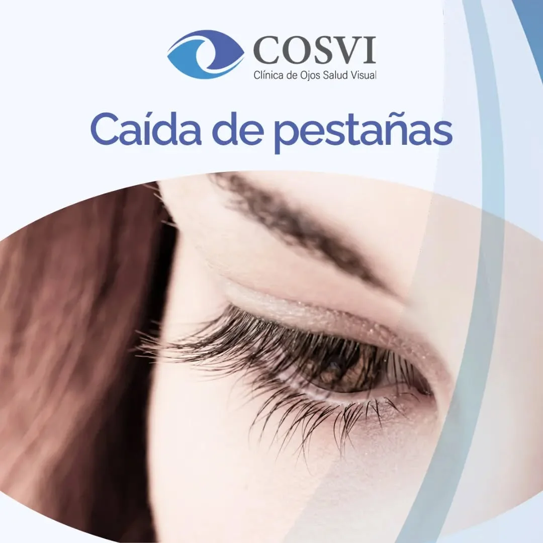 Caída Excesiva de Pestañas